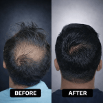 file_000000002e5072089946b3b2f529fc6d (1)